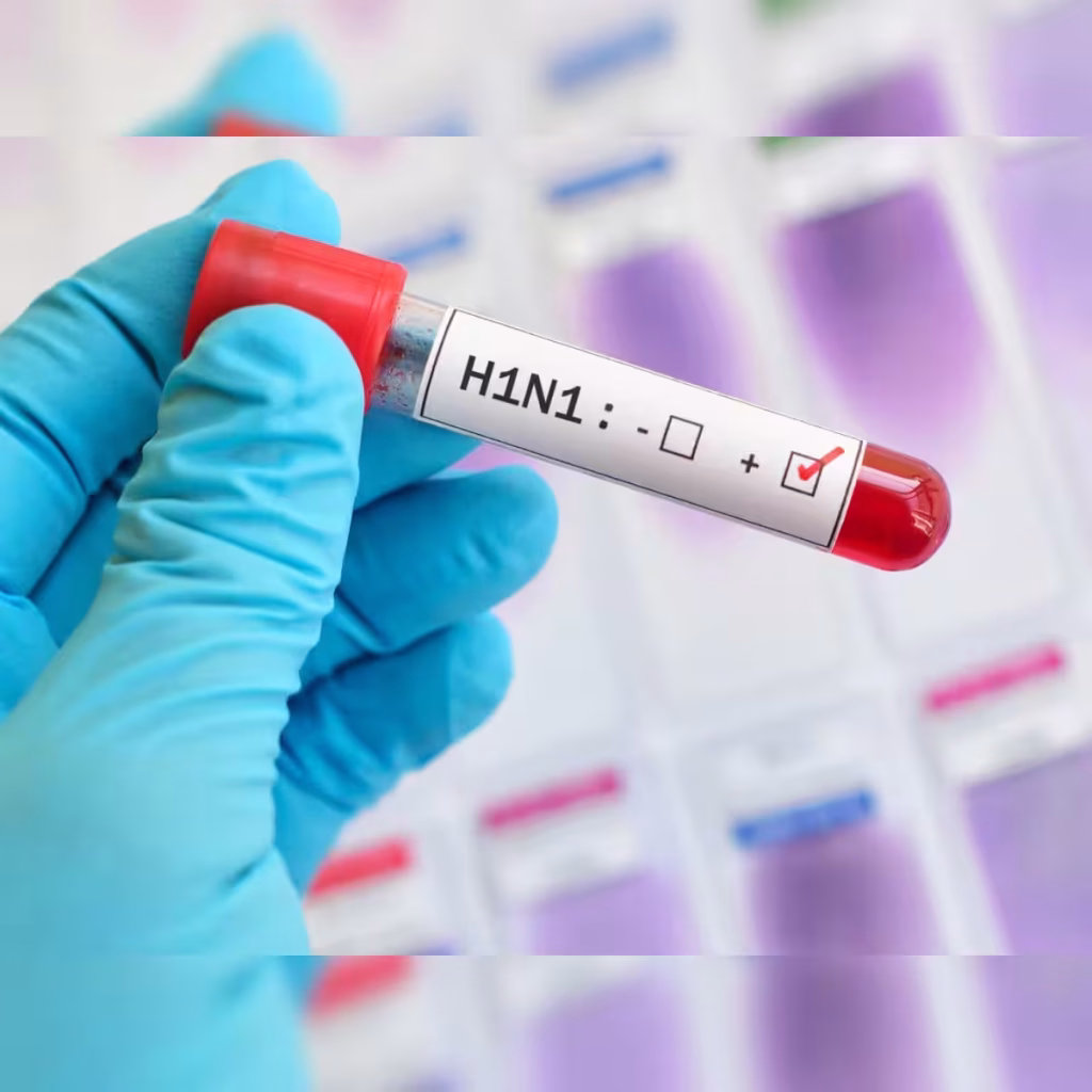 Delhi’s Monsoon Affects H1N1 Infections